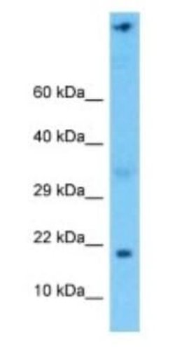 NDUFA6 Rabbit anti-Human, Polyclonal, Novus Biologicals:Antibodies:Primary